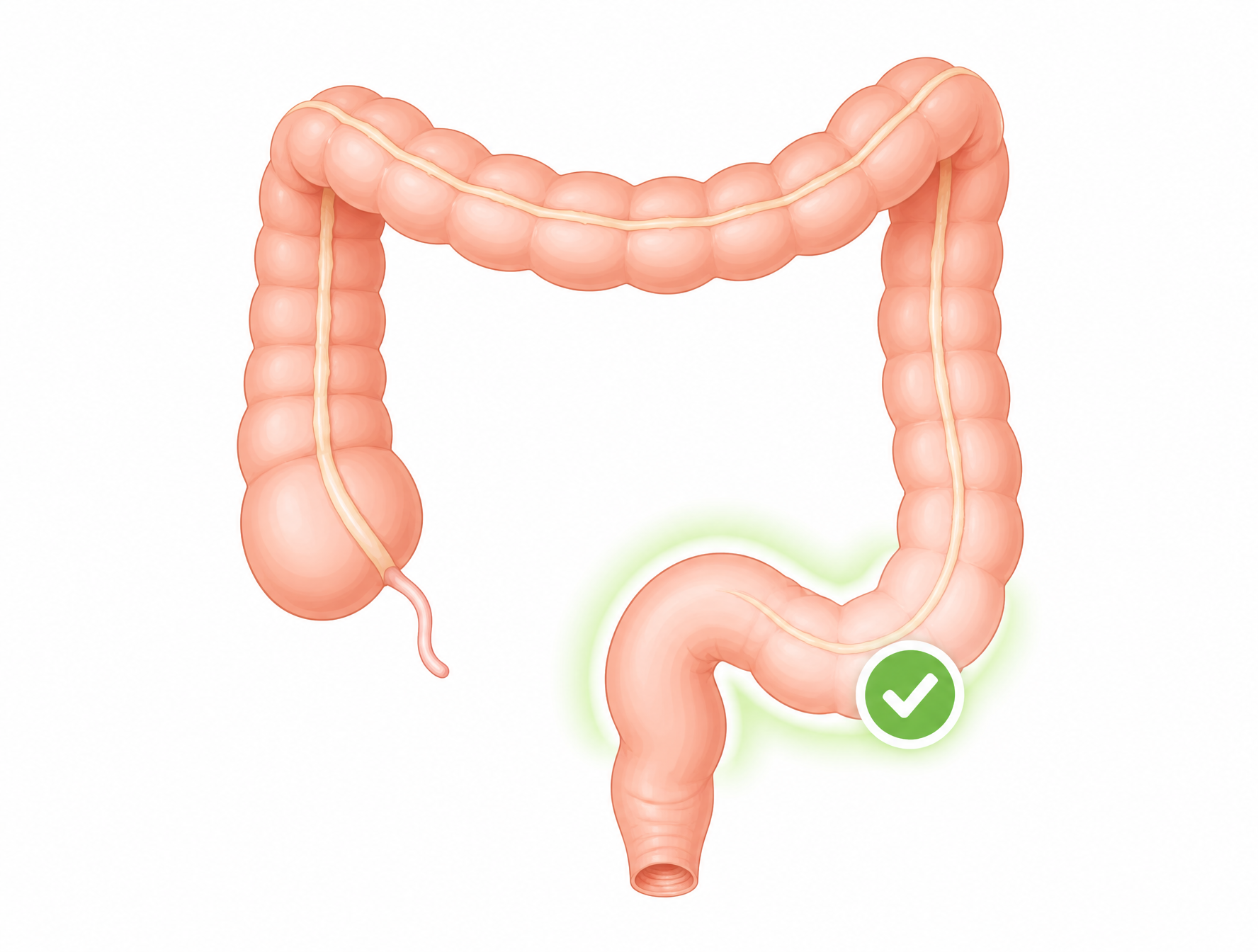 Illustration of the large intestine with the lower sigmoid section highlighted and a green check mark